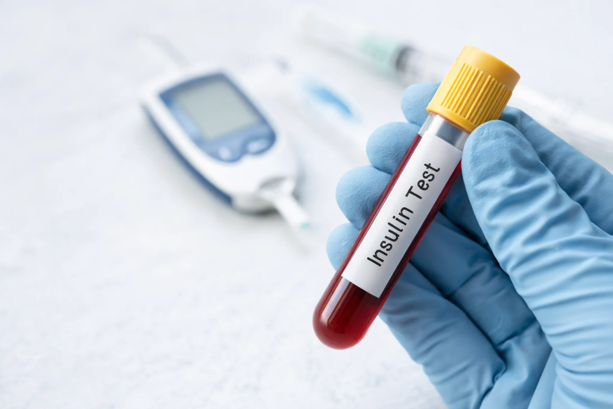 Insulin Fasting Test
